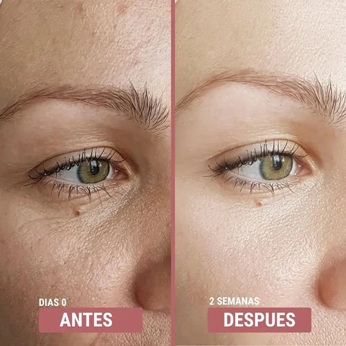 Glow Boost Serum