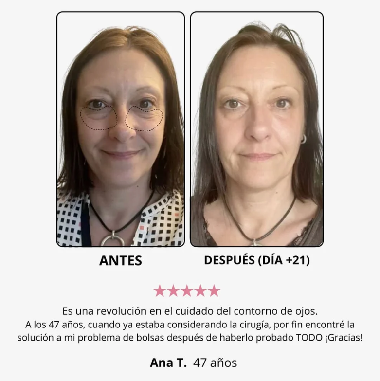 Crema de Luz Roja para el Contorno de Ojos
