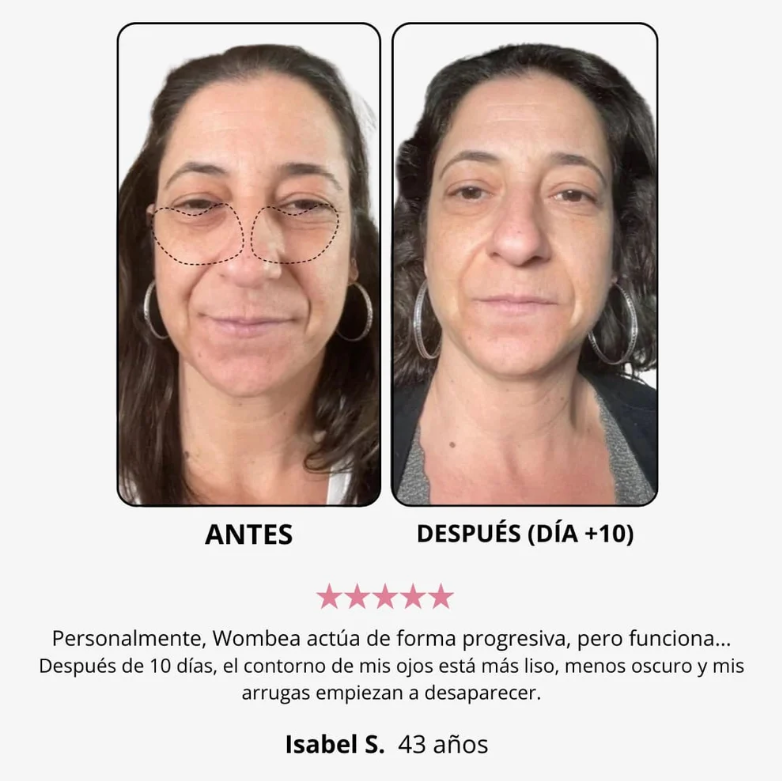Crema de Luz Roja para el Contorno de Ojos