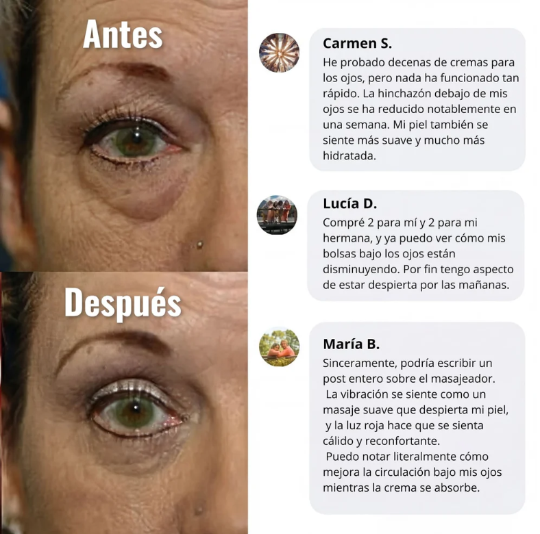 Crema de Luz Roja para el Contorno de Ojos
